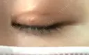 二重埋没 Olino美容外科・美容皮膚科 DAY 28 サムネイル用