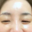 その他（目元） ももスキンケアクリニック DAY 7 サムネイル用