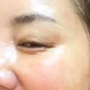 その他（目元） ももスキンケアクリニック DAY 7 サムネイル用