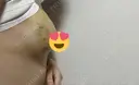 豊胸（シリコン＋脂肪併用） BIANCA表参道 DAY 3 サムネイル用
