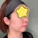 あごプロテーゼ くさのたろうクリニック DAY 189 サムネイル用