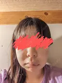 メーラーファット除去 WOM CLINIC GINZA （ワム クリニック ギンザ） DAY 0 サムネイル用