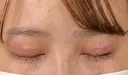 二重切開 / 目頭切開 藤・ナチュレ美容クリニック 恵比寿院 DAY 36 サムネイル用