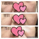 ポテンツァ GAYA body design clinic AFTER サムネイル用