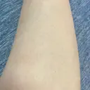 医療脱毛（脚） / その他（口元） リナクリニック DAY 4 サムネイル用