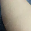 医療脱毛（脚） / その他（口元） リナクリニック AFTER サムネイル用