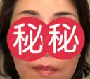 アートメイク（眉） / アートメイク（唇） APスキンクリニック銀座 DAY 2 サムネイル用