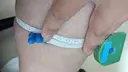 脂肪吸引（脚） アムルーズ美容外科クリニック 横浜院 DAY 67 サムネイル用
