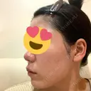 ポテンツァ レナータクリニック 立川院 DAY 11 サムネイル用