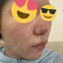 ポテンツァ レナータクリニック 立川院 AFTER サムネイル用