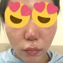 ポテンツァ レナータクリニック 立川院 DAY 20 サムネイル用