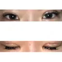 眼瞼下垂（切開） ピュア形成外科医院 DAY 23 サムネイル用