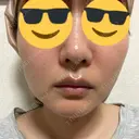 ルメッカ シェリークリニック 福岡院 AFTER サムネイル用
