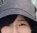 ヒアルロン酸注入（涙袋） 青山外苑前クリニック DAY 3 サムネイル用