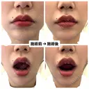 口角挙上 宇都宮竹内クリニック AFTER サムネイル用