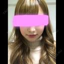 骨削り（エラ） / 骨削り（頬） / その他（輪郭） / 目尻切開 / タレ目形成・グラマラスライン（切開） / 輪郭修正 ウォンジン（Wonjin）整形外科 DAY 26 サムネイル用