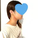 脂肪吸引注射（顔） 湘南美容クリニック 秋葉原院 DAY 1 サムネイル用