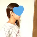 脂肪吸引注射（顔） 湘南美容クリニック 秋葉原院 DAY 1 サムネイル用