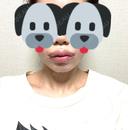 脂肪吸引（顔） / 口唇縮小術 / 口角挙上 / ジョールファット除去 / ヒアルロン酸注入（あご） / ボトックス（エラ・小顔） / ボトックス（口角） Otus Clinic 【オータスクリニック】 DAY 26 サムネイル用