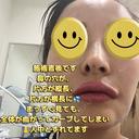 その他（鼻） / 鼻尖縮小 / 肌ヒアルロン酸注入（たるみ・シワ改善） / ヒアルロン酸注入（唇） / シワ取りボトックス / ヒアルロン酸注入（ほうれい線） 東京形成美容外科 船橋院 DAY 0 サムネイル用