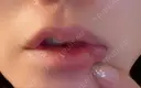 ヒアルロン酸注入（唇） / ボトックス（口角） ルラ美容クリニック 上野院 DAY 2 サムネイル用