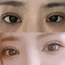 二重埋没 ルラ美容クリニック 神戸院 AFTER サムネイル用