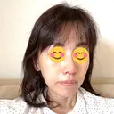 鼻尖形成（切開） / 鼻中隔延長（切開） / 小鼻縮小（切開） / 鼻尖縮小 グローバルビューティークリニック 東京院 DAY 14 サムネイル用