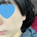 光治療（フォトフェイシャルなど） メディアージュクリニック 名古屋院 DAY 4 サムネイル用