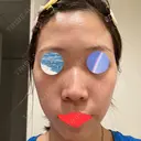 ルメッカ ルラ美容クリニック 渋谷本院 AFTER サムネイル用
