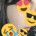 ほくろ・いぼ除去レーザー（肌） 心斎橋形成外科スキンケアクリニック AFTER サムネイル用