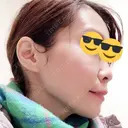 ヒアルロン酸注入（あご） TCB東京中央美容外科 世田谷院 DAY 3 サムネイル用