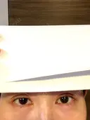 二重埋没 / 糸リフト / 下まぶたの脂肪取り / 目元修正 / 肌ヒアルロン酸注入（たるみ・シワ改善） ネビュラクリニック 広島院 DAY 1 サムネイル用