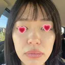 光治療（フォトフェイシャルなど） APOLLO BEAUTY CLINIC DAY 2 サムネイル用