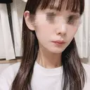 エレクトロポレーション JBCジュノビューティークリニック 新宿三丁目院 AFTER サムネイル用
