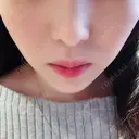 脂肪溶解注射（顔） S Beauty Clinic DAY 50 サムネイル用