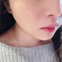 脂肪溶解注射（顔） S Beauty Clinic DAY 50 サムネイル用