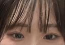 ヒアルロン酸注入（涙袋） 恵聖会クリニック 心斎橋院 DAY 227 サムネイル用