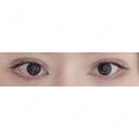二重切開 / 眼瞼下垂（切開） / その他（目元） / 上まぶたたるみ取り / 上まぶたの脂肪取り / 目元修正 リビジョンクリニック（旧：池本形成外科・美容外科） DAY 19 サムネイル用