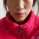 セットバック カトレア歯科・美容クリニック BEFORE サムネイル用