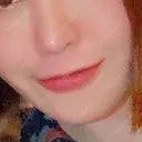 ヒアルロン酸注入（唇） / ボトックス（口角） アクトリー勝どきウェルネスメディカルクリニック BEFORE サムネイル用