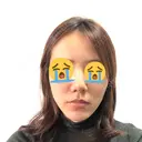 骨切り（あご） / 脂肪吸引（顔） 銀座マイアミ美容外科 BEFORE サムネイル用