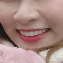 鼻尖形成（切開） / 小鼻縮小（切開） 湘南美容クリニック 神戸院 BEFORE サムネイル用
