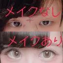 二重切開 / 目頭切開 / ヒアルロン酸注入（涙袋） FROM B整形外科 (旧バウム整形外科) BEFORE サムネイル用