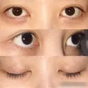 目尻切開 / 目尻靭帯移動 FROM B整形外科 (旧バウム整形外科) BEFORE サムネイル用