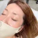 アートメイク（眉） MURAL CLINIC BEFORE サムネイル用