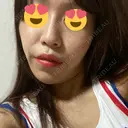 糸リフト ルラ美容クリニック 渋谷本院 BEFORE サムネイル用