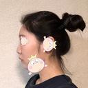 隆鼻術 / 鼻尖形成（切開） / 鼻中隔延長（切開） / 小鼻縮小（切開） / プロテーゼ除去 / 鼻尖縮小 FROM B整形外科 (旧バウム整形外科) BEFORE サムネイル用