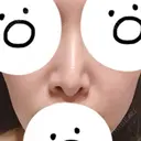 隆鼻術 / 鼻中隔延長（切開） / 小鼻縮小（切開） / 軟骨移植 / 鼻修正 / 鼻孔縁下降 FROM B整形外科 (旧バウム整形外科) BEFORE サムネイル用