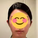 アートメイク（唇） LEAGRANT CLINIC 中目黒 BEFORE サムネイル用