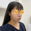 その他（鼻） ルラ美容クリニック 大宮院 / ルラスキンクリニック 大宮院 BEFORE サムネイル用